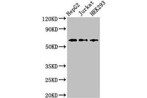 Western Blot Positive WB detected in: HepG2 whole cell lysate, Jurkat whole cell lysate, HEK293 whole cell lysate All lanes: CD96 antibody at 2. (CD96 antibody  (AA 306-395))