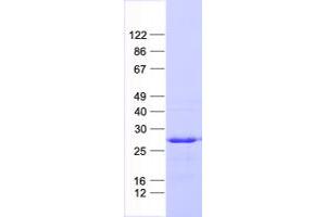 Validation with Western Blot (ASB13 Protein (His tag))