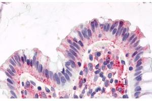 Anti-GPR15 antibody  ABIN1048731 IHC staining of human colon, surface epithelium.