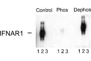 Western blots of immunoprecipitates from HEK 293 cells transfected with 1. (IFNAR1 antibody  (pSer535, pSer539))
