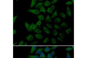 Immunofluorescence analysis of U2OS cells using PLOD2 Polyclonal Antibody (PLOD2 antibody)