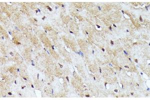 Immunohistochemistry of paraffin-embedded Mouse heart using YAP1 Polyclonal Antibody at dilution of 1:100 (40x lens).