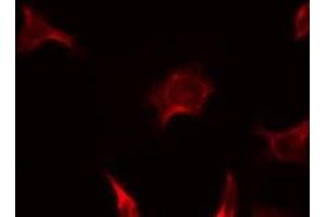 ABIN6275849 staining Hela by IF/ICC. (MERTK antibody  (Internal Region))