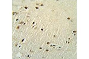 Immunohistochemistry (IHC) image for anti-X-Ray Repair Complementing Defective Repair in Chinese Hamster Cells 6 (XRCC6) (AA 228-254) antibody (ABIN3029656)