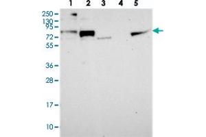 Western blot analysis of Lane 1: RT-4, Lane 2: U-251 MG, Lane 3: Human Plasma, Lane 4: Liver, Lane 5: Tonsil with NOL8 polyclonal antibody  at 1:250-1:500 dilution. (NOL8 antibody)