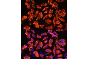 Immunofluorescence analysis of U2OS cells using TCTN1 Rabbit pAb (ABIN7270757) at dilution of 1:100. (TCTN1 antibody  (AA 130-310))