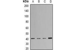 Western blot analysis of MacroH2A1 expression in Jurkat (A), Hela (B), mouse liver (C), rat lung (D) whole cell lysates. (H2AFY antibody)
