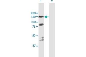 Western Blot analysis of PARP1 expression in transfected 293T cell line by PARP1 MaxPab polyclonal antibody. (PARP1 antibody  (AA 1-1014))