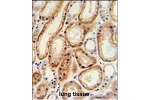 GALNT5 Antibody (N-term) (ABIN653934 and ABIN2843166) IHC analysis in formalin fixed and paraffin embedded human normal lung tissue followed by peroxidase conjugation of the secondary antibody and DAB staining. (GALNT5 antibody  (N-Term))