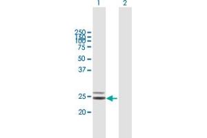 Western Blot analysis of COQ4 expression in transfected 293T cell line by COQ4 MaxPab polyclonal antibody. (COQ4 antibody  (AA 1-265))
