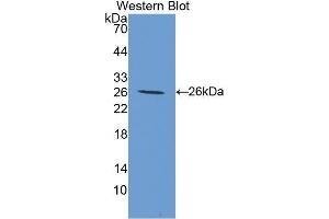Western Blotting (WB) image for anti-Transglutaminase 3 (E Polypeptide, Protein-Glutamine-gamma-Glutamyltransferase) (TGM3) (AA 468-693) antibody (ABIN1174982) (TGM3 antibody  (AA 468-693))