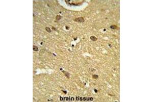 Immunohistochemistry (IHC) image for anti-Ubiquitin Associated Protein 1 (UBAP1) antibody (ABIN3003932) (UBAP1 antibody)
