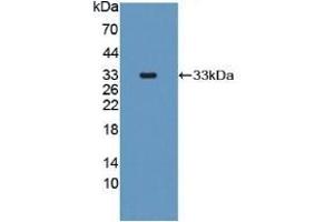 Detection of Recombinant MRP1, Human using Polyclonal Antibody to Multidrug Resistance Associated Protein 1 (MRP1) (ABCC1 antibody)