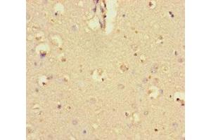 Immunohistochemistry of paraffin-embedded human brain tissue using ABIN7145840 at dilution of 1:100 (KCTD16 antibody  (AA 201-428))