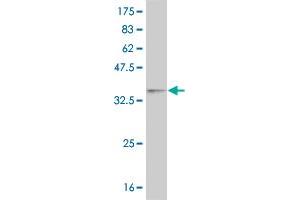 Western Blot detection against Immunogen (35. (WT1 antibody  (AA 349-439))
