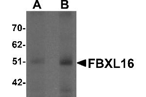 Western Blotting (WB) image for anti-F-Box and Leucine-Rich Repeat Protein 16 (FBXL16) (C-Term) antibody (ABIN1030390) (FBXL16 antibody  (C-Term))