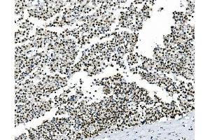 IHC analysis of HOXD11 using anti-HOXD11 antibody (ABIN7603174). (HOXD11 antibody  (N-Term))