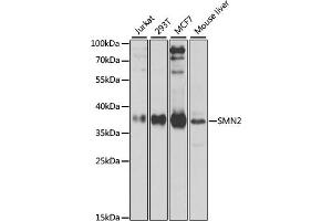Western blot analysis of extracts of various cell lines, using SMN2 antibody (ABIN6127948, ABIN6148135, ABIN6148138 and ABIN6216175) at 1:1000 dilution. (SMN2 antibody  (AA 1-197))