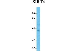 Host:  Rabbit  Target Name:  SIRT4  Sample Tissue:  Human Fetal Liver  Antibody Dilution:  1. (SIRT4 antibody  (Middle Region))