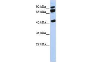 Image no. 1 for anti-DEAD (Asp-Glu-Ala-Asp) Box Polypeptide 17 (DDX17) (AA 107-156) antibody (ABIN6742675) (DDX17 antibody  (AA 107-156))