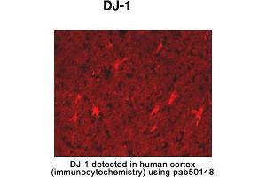 Image no. 2 for anti-Parkinson Protein 7 (PARK7) (AA 150-189), (C-Term) antibody (ABIN363457) (PARK7/DJ1 antibody  (C-Term))