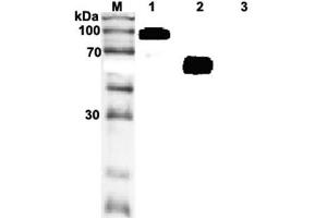 Western blot analysis of recombinant human soluble ST2 using anti-ST2 (human), mAb (ST33868)  at 1:2,000 dilution. (IL1RL1 antibody)