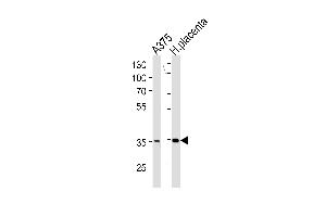 AKR1B1 Antibody (C-term) (ABIN389205 and ABIN2839363) western blot analysis in  cell line and human placenta tissue lysates (35 μg/lane).