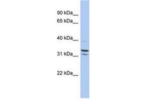 Image no. 1 for anti-Family with Sequence Similarity 92, Member B (FAM92B) (AA 71-120) antibody (ABIN6743910) (FAM92B antibody  (AA 71-120))