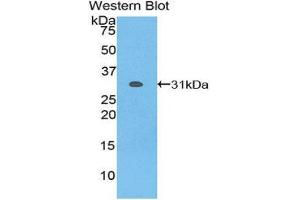 Western Blotting (WB) image for anti-Nicastrin (NCSTN) (AA 420-655) antibody (ABIN1859974) (Nicastrin antibody  (AA 420-655))