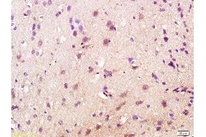 Formalin-fixed and paraffin embedded rat brain labeled with Anti-CD200R/Orexin receptor Polyclonal Antibody, Unconjugated  at 1:200 followed by conjugation to the secondary antibody and DAB staining. (OX1R/OX2R antibody  (AA 321-425))