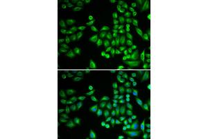 Immunofluorescence (IF) image for anti-Protein tyrosine Phosphatase, Non-Receptor Type 1 (PTPN1) antibody (ABIN1980139) (PTPN1 antibody)