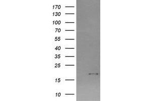 Image no. 2 for anti-Cancer/testis Antigen 1B (CTAG1B) antibody (ABIN1499897) (CTAG1B antibody)