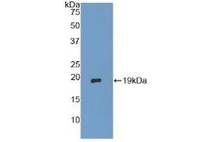 Detection of Recombinant dSIP, Human using Polyclonal Antibody to Delta-Sleep Inducing Peptide (dSIP) (TSC22D3 antibody  (AA 1-134))
