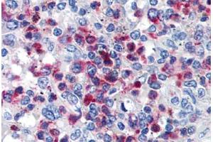 Human Spleen (formalin-fixed, paraffin-embedded) stained with CD63 antibody ABIN239811 at 10 ug/ml followed by biotinylated anti-mouse IgG secondary antibody ABIN481714, alkaline phosphatase-streptavidin and chromogen. (CD63 antibody)