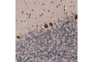 Immunohistochemical staining of human cerebellum with SOWAHB polyclonal antibody  shows strong cytoplasmic and nuclear positivity in Purkinje cells and molecular layer.