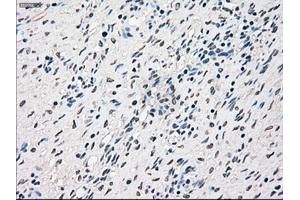 Immunohistochemical staining of paraffin-embedded Ovary tissue using anti-RAD9Amouse monoclonal antibody. (RAD9A antibody)