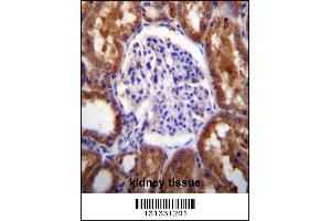 SLC12A6 Antibody immunohistochemistry analysis in formalin fixed and paraffin embedded human kidney tissue followed by peroxidase conjugation of the secondary antibody and DAB staining. (SLC12A6 antibody  (N-Term))