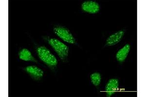 Immunofluorescence of purified MaxPab antibody to PDE4DIP on HeLa cell. (PDE4DIP antibody  (AA 1-177))