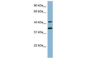 BLNK antibody used at 1 ug/ml to detect target protein. (B-Cell Linker antibody  (Middle Region))