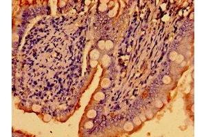 Immunohistochemistry of paraffin-embedded human small intestine tissue using ABIN7169226 at dilution of 1:100 (WNK2 antibody  (AA 1177-1464))