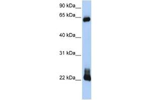 RHOD antibody used at 1 ug/ml to detect target protein. (RHOD antibody  (C-Term))