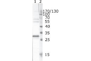 Western Blot testing of HIV-1 recombinant Nef protein. (HIV-1 Nef (AA 195-205) antibody)