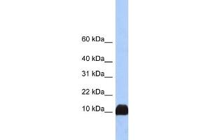 WB Suggested Anti-PFN1 Antibody Titration:  0.