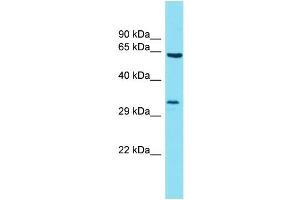 Host: Rabbit Target Name: BTBD19 Sample Type: 721_B Whole Cell lysates Antibody Dilution: 1.
