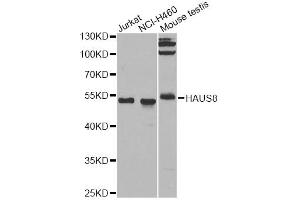 Western blot analysis of extracts of various cell lines, using HAUS8 antibody (ABIN5975204) at 1/1000 dilution.