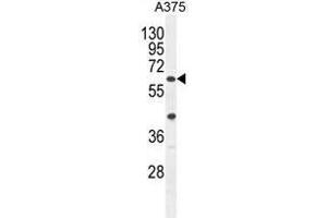 ACF Antibody (C-term) western blot analysis in A375 cell line lysates (35ug/lane). (A1CF antibody  (C-Term))