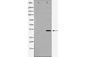 Western blot analysis of extracts of 293T, using FCER2 antibody. (FCER2 antibody  (C-Term))