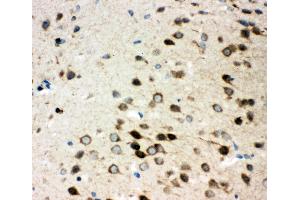 Anti-Integrin alpha 3 antibody, IHC(P) IHC(P): Rat Brain Tissue (ITGA3 antibody  (N-Term))