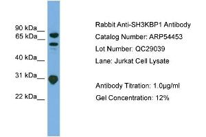 WB Suggested Anti-SH3KBP1  Antibody Titration: 0. (SH3KBP1 antibody  (N-Term))