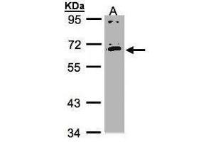 Western blot analysis of 30 ug whole cell lysate (A:HeLa S3) using a 7. (IL17RC antibody)